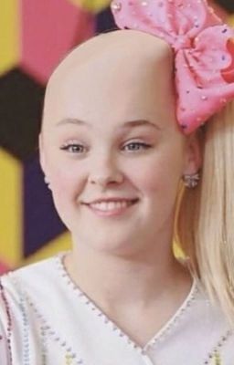 Jojo Siwa Losing Her Hairline 