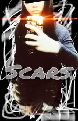 Scars. 